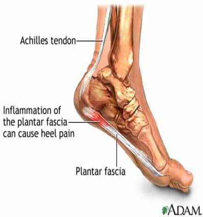 Plantar Fascia