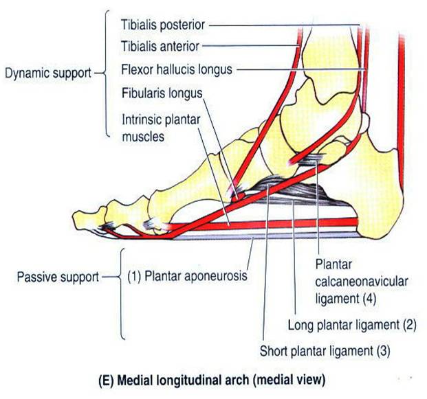 Plantar Faciitis Illustration